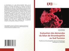 Bookcover of Evaluation des demandes du bilan de thrombophilie au Sud Tunisien