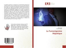 Bookcover of La Tumorigenèse Hépatique