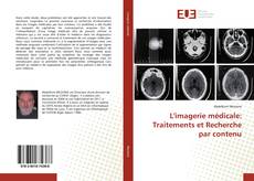 L'imagerie médicale: Traitements et Recherche par contenu kitap kapağı