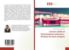 Couverture de Cancer solide et biomarqueurs précoces : Analyse du tissu sanguin