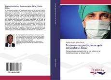 Tratamiento por laparoscopía de la litiasis biliar kitap kapağı