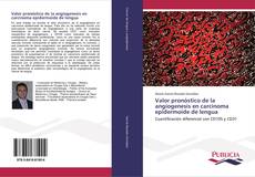 Valor pronóstico de la angiogenesis en carcinoma epidermoide de lengua kitap kapağı