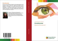 Ceratocone kitap kapağı