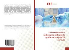 Capa do livro de Le recouvrement radiculaire utilisant la greffe de conjonctif enfouie 