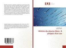 Bookcover of Atrésie du jéjuno-iléon. A propos d'un cas
