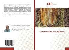 Cicatrisation des brûlures kitap kapağı