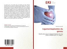 Buchcover von Ligamentoplasties du genou