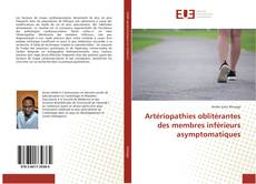 Bookcover of Artériopathies oblitérantes des membres inférieurs asymptomatiques