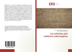 Bookcover of Les cellulites péri orbitaires odontogènes