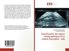 Bookcover of Classification des signes échographiques d’un nodule thyroïdien : vale