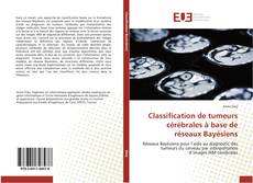 Bookcover of Classification de tumeurs cérébrales à base de réseaux Bayésiens