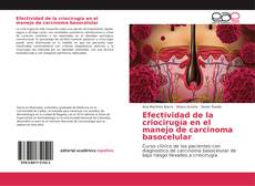 Efectividad de la criocirugía en el manejo de carcinoma basocelular的封面