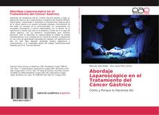 Abordaje Laparoscópico en el Tratamiento del Cáncer Gástrico kitap kapağı