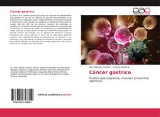 Обложка Cáncer gastrico