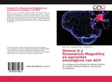 Обложка Dímero D y Resonancia Magnética en pacientes oncológicos con ACV