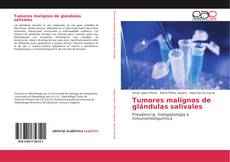 Tumores malignos de glándulas salivales的封面