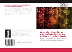 Anemia refractaria con sideroblastos en anillo y trombocitosis kitap kapağı