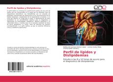 Bookcover of Perfil de lipidos y Dislipidemias