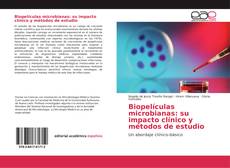 Biopelículas microbianas: su impacto clínico y métodos de estudio kitap kapağı