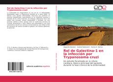 Обложка Rol de Galectina-1 en la infección por Trypanosoma cruzi