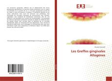 Capa do livro de Les Greffes gingivales Allogènes 