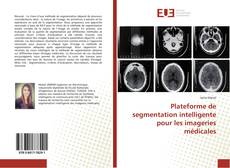 Buchcover von Plateforme de segmentation intelligente pour les imageries médicales