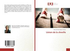 Buchcover von Lésion de la cheville