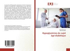 Bookcover of Hypoglycémies du sujet âgé diabétique