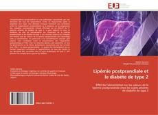 Bookcover of Lipémie postprandiale et le diabète de type 2