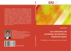 Copertina di Les infections de prothèses de hanche à staphylocoques