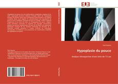 Bookcover of Hypoplasie du pouce