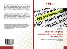 Etude de la rigidité artérielle chez les malades hypertendus:的封面