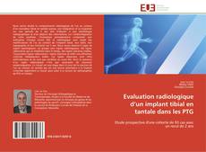 Capa do livro de Evaluation radiologique d’un implant tibial en tantale dans les PTG 