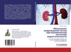 Bookcover of Механизмы повреждения почки при ишемической почечной недостаточности