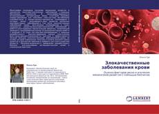 Capa do livro de Злокачественные заболевания крови 