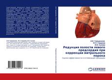 Buchcover von Редукция полости левого предсердия при коррекции митрального порока