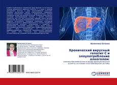 Bookcover of Хронический вирусный гепатит С и злоупотребление алкоголем: