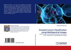 Buchcover von Prostate Cancer Classification using Multispectral Images