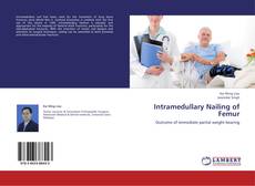 Capa do livro de Intramedullary Nailing of Femur 