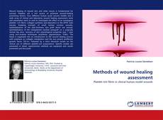 Bookcover of Methods of wound healing assessment