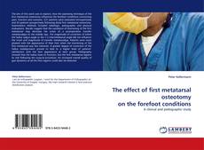 The effect of first metatarsal osteotomy on the forefoot conditions kitap kapağı
