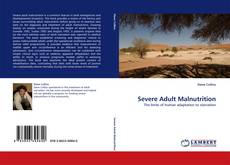 Buchcover von Severe Adult Malnutrition