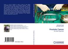 Capa do livro de Prostate Cancer 