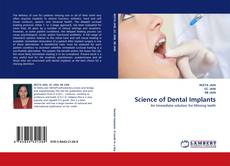 Capa do livro de Science of Dental Implants 