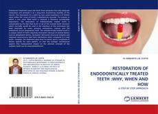 Borítókép a  RESTORATION OF ENDODONTICALLY TREATED TEETH :WHY, WHEN AND HOW - hoz