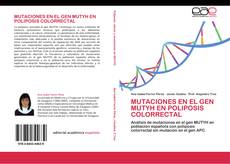 Обложка Mutaciones en el gen MUTYH en poliposis colorrectal