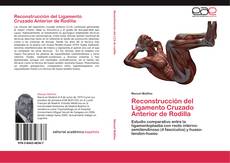 Capa do livro de Reconstrucción del Ligamento Cruzado Anterior de Rodilla 