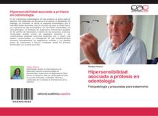 Bookcover of Hipersensibilidad asociada a prótesis en odontología