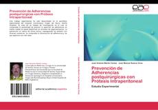 Buchcover von Prevención de Adherencias postquirúrgicas con Prótesis Intraperitoneal