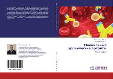 Bookcover of Ювенильные хронические артриты